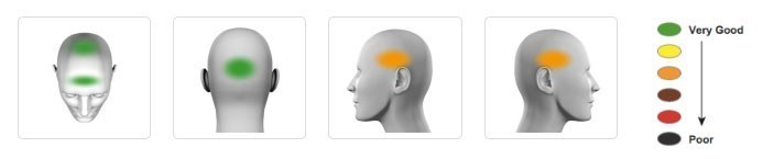 Imágenes de una cabeza vista desde diferentes ángulos indicando con colores el nivel de protección.