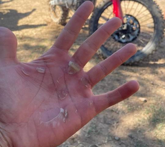 Marc Márquez mano